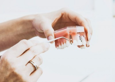 Fabricantes de implantes